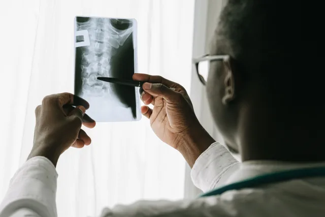 Close-up of a doctor examining a spine X-ray film with a pen in a hospital setting. Chiropractic practice services: six workflow ideas